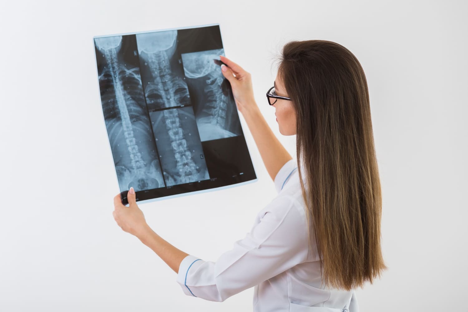 Tratamiento escoliosis en Veracruz: Especialistas en Traumatología y Ortopedia